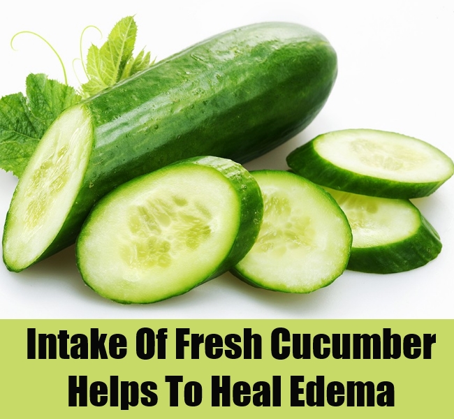 Natural Ways To Cure Edema Natural Ways To Cure Edema