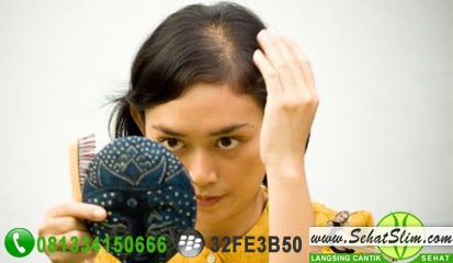 Cara Menumbuhkan Rambut Secara Cepat dan Alami Cara Menumbuhkan Rambut