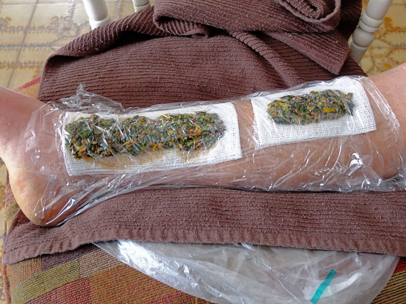 White Bread Poultice at Stephen Barrett blog