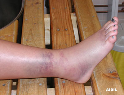 prostituées ljubljana