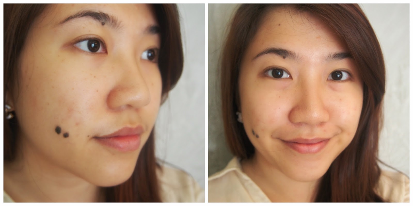 Rejuran Skin Booster: Unlock The Secret To Ageless, Radiant Skin