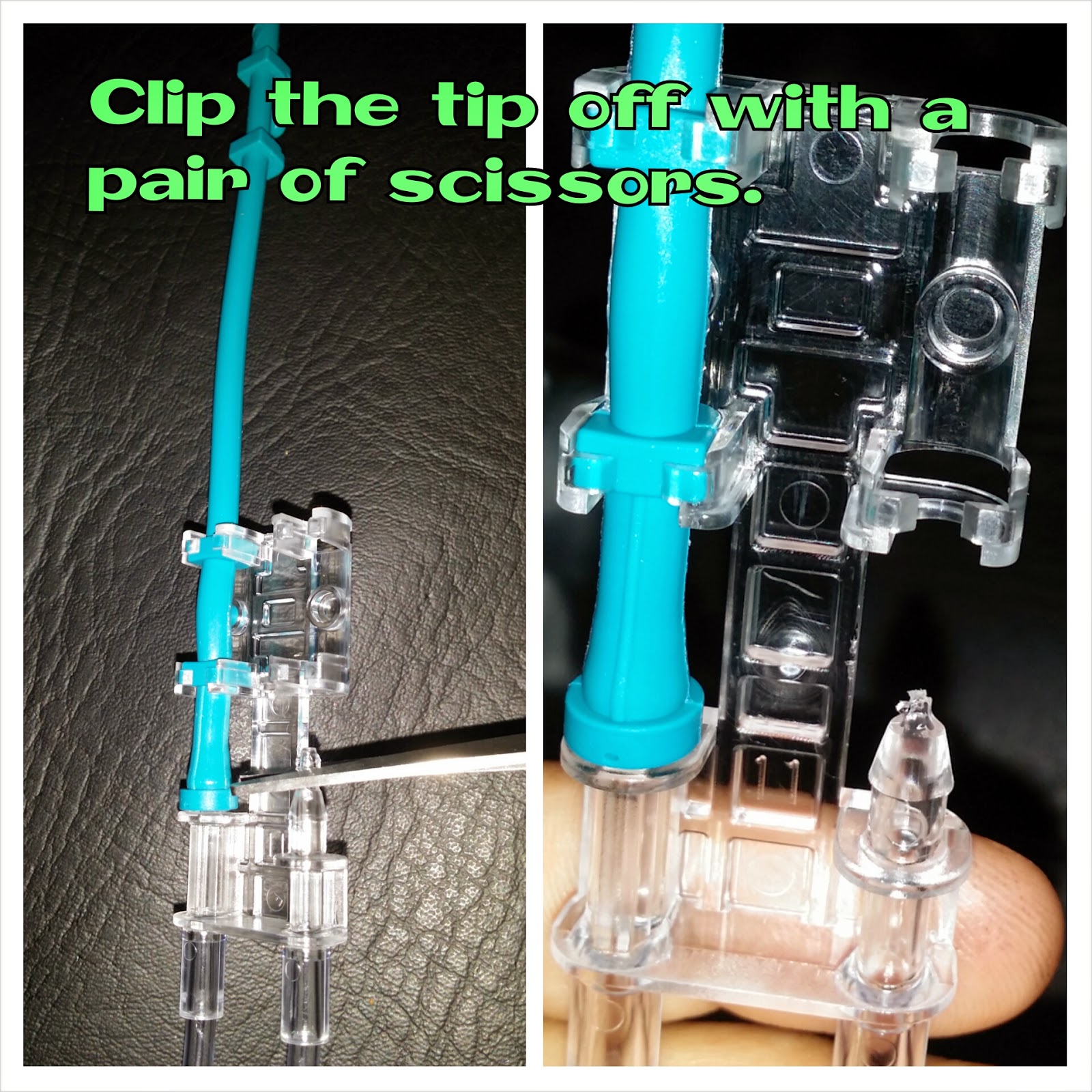 Spastic Quadriplegic Cerebral Palsy How to Convert Zevex Infinity Pump