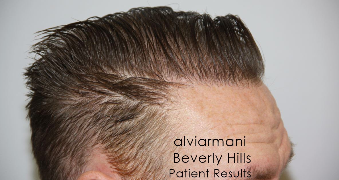 AlviArmani Patient's Results #6