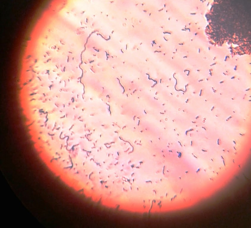 CLUBES DE CIENCIAS Bacterias del yogurt. Observación real al microscopio.