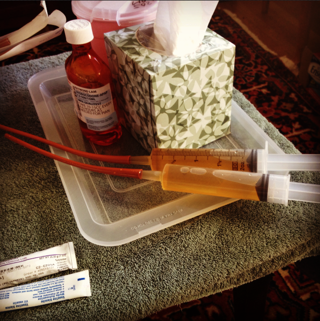 August 2012 A Tale of TwoJaw Surgery