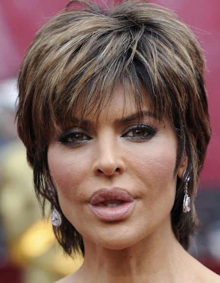 Chatter Busy: Lisa Rinna Lips Before And After