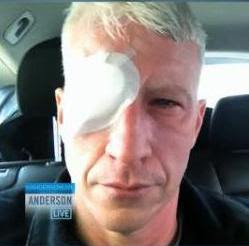 Anderson-Cooper-blind-eye-patch.jpg