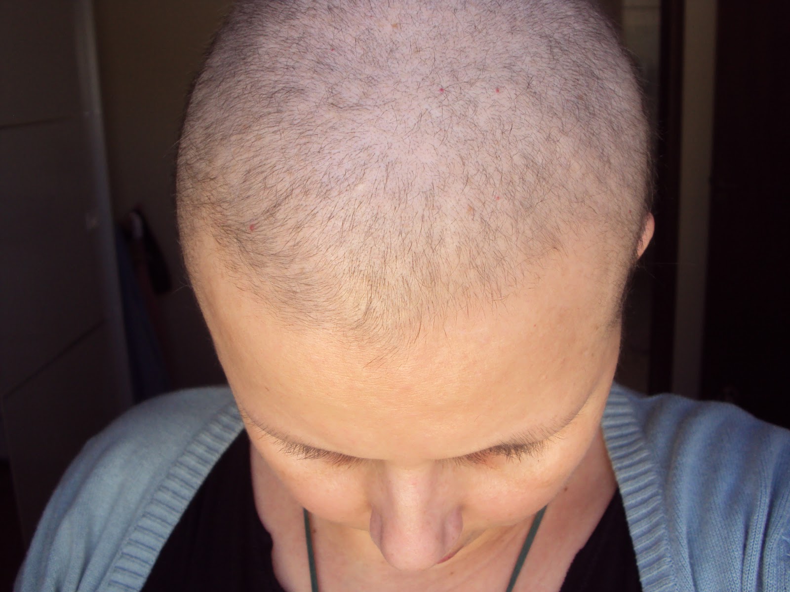 Viver um dia a cada dia....: Acompanhamento de crescimento do cabelo