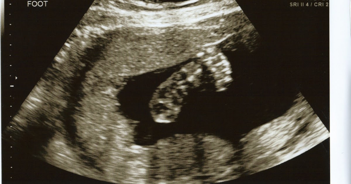 Growing Baby G! 3D ULTRASOUND!!! Baby G at 25 weeks!