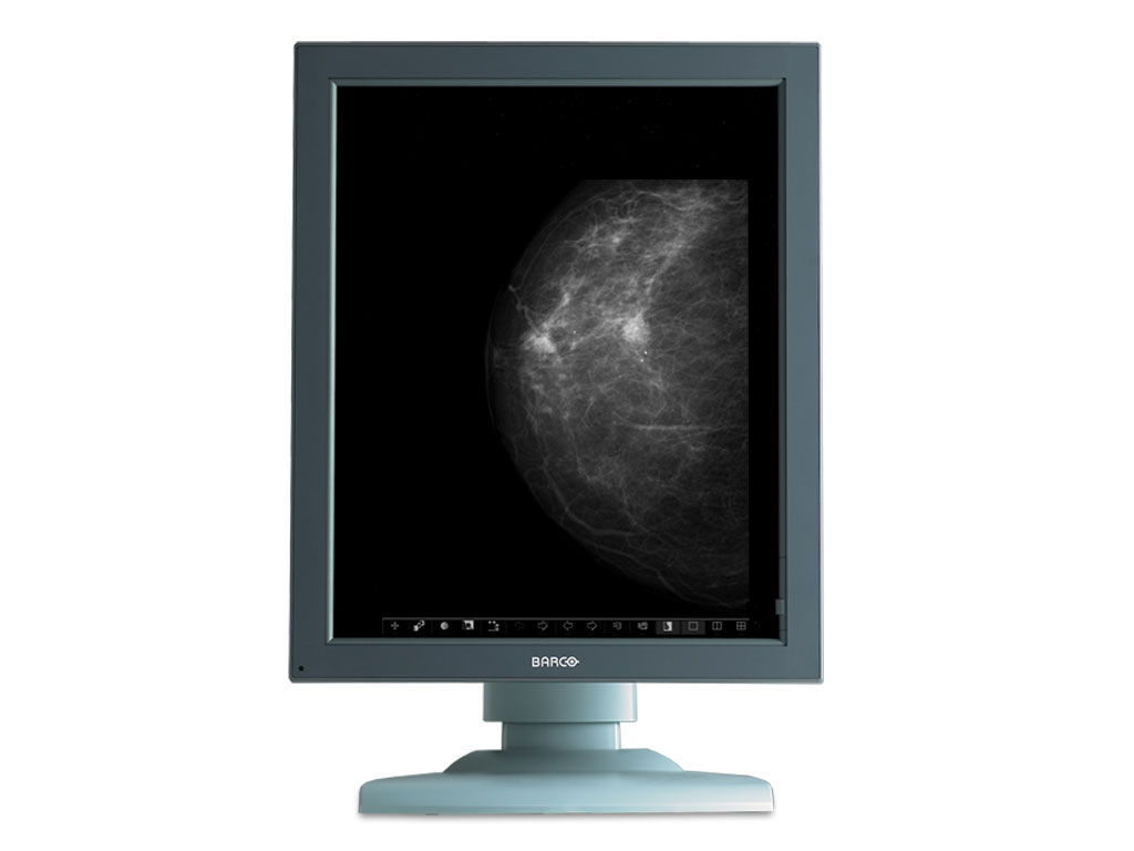 Ampronix Medical Imaging Barco Coronis 5MP Mammo (MDMG5121) Mammo LCD