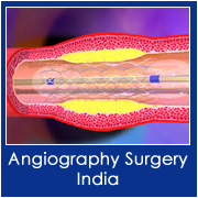 Angiography in India