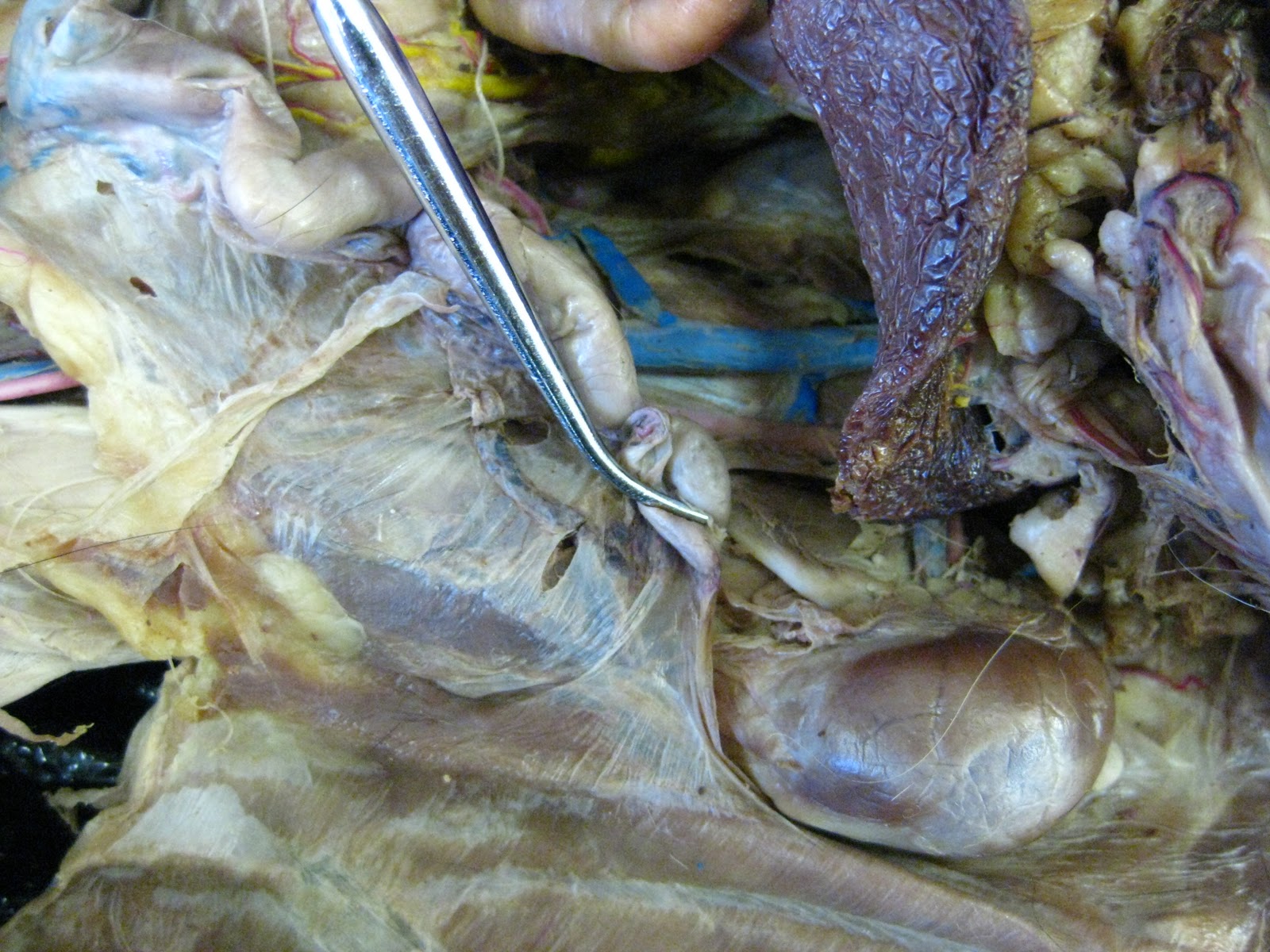 Kitty Tubes - Digestive System, Reproductive System, and Urinary System