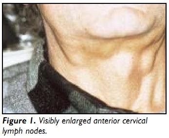 enlarged lymph nodes