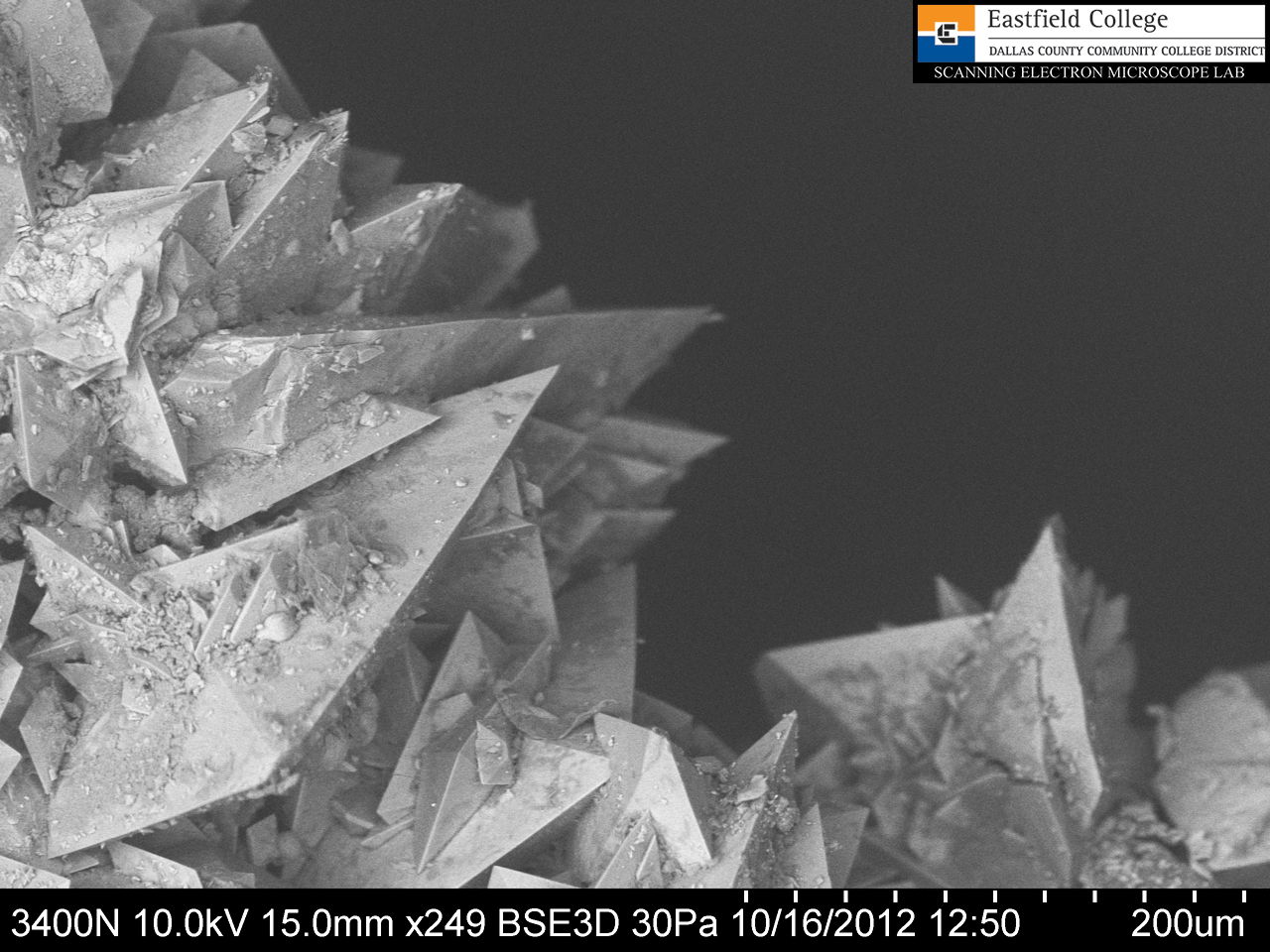 Scanning Electron Microscope Blog A Kidney Stone OUCH!!