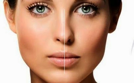 Blog De Carmen Moda Y Belleza Rinoplastia Una Nariz Perfecta