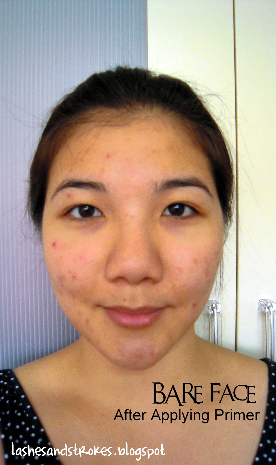 Flawed Skin