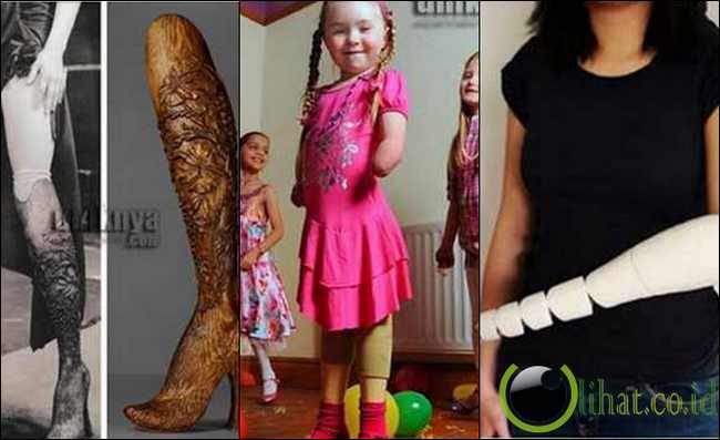 5 Tangan Palsu dan Kaki Palsu yang paling Aneh dan Unik 5 Tangan Palsu dan Kaki Palsu yang paling Aneh dan Unik