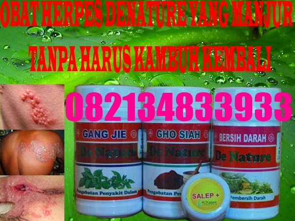 Obat Herpes Zoster Alami