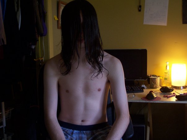 alanon and gaining weight