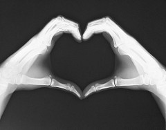 love radiology