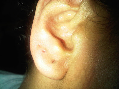 Cultural Reciprocity Next Steps Ear Stretch 12 Gauge To 10 12 Gauge Ear Hole Middle Before Stretch