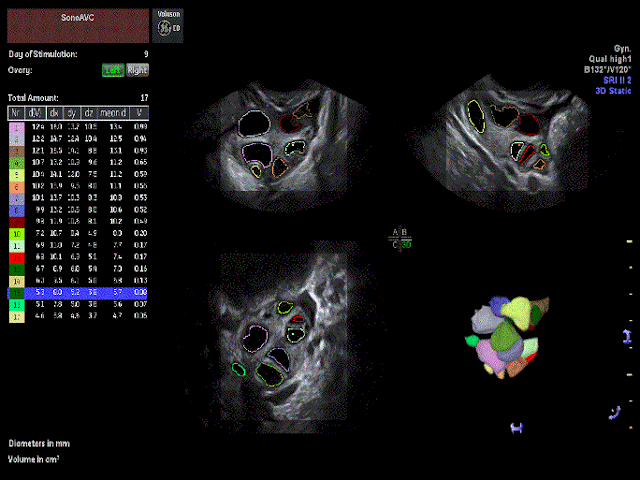 Tuesday, or Wednesday.