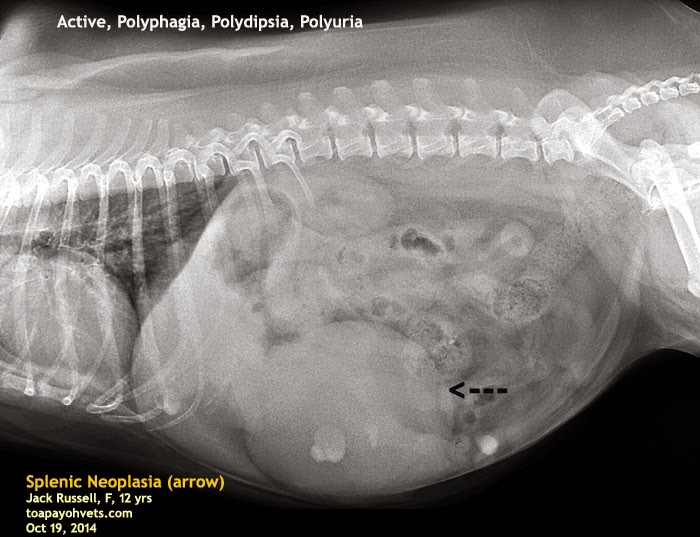 Enlarged Liver X Ray vrogue.co