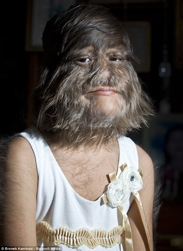 Budak Serigala