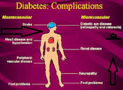 Diabetics solution