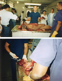 Exame cadaverico