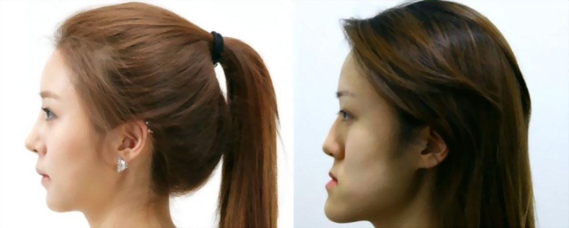 Operasi Pembendungan yang Dilakukan oleh Pasukan Keamanan Rio de Janeiro