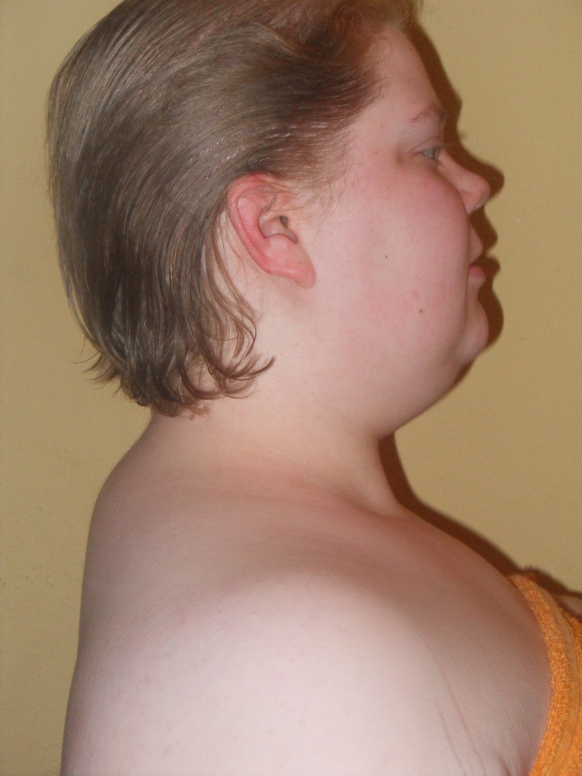 Plethoric Facies