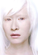Albinismul