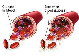 What Is Low Blood Sugar Range Chart