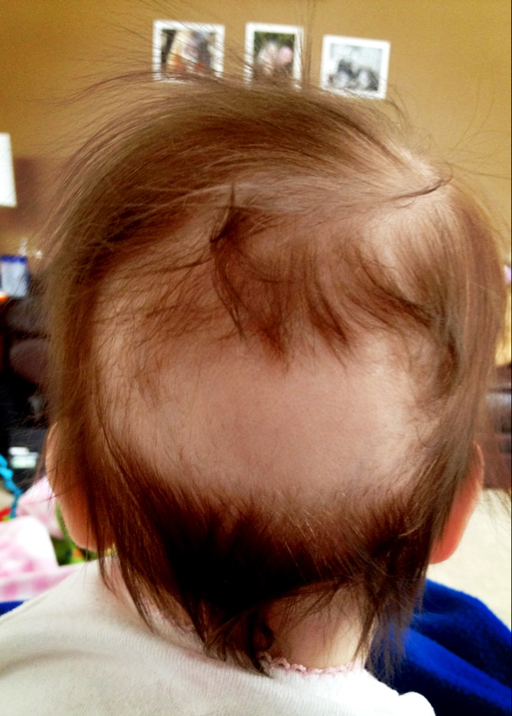 ...by Nic♥le Cradle Cap Confession