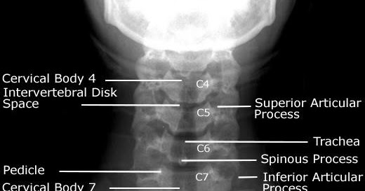 Medical Addicts: Labeled anatomy of the cervical spine ... diaphragm diagram 