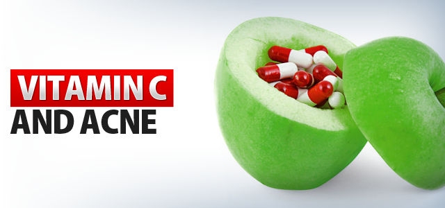 Use Vitamin C to Cure Your Acne