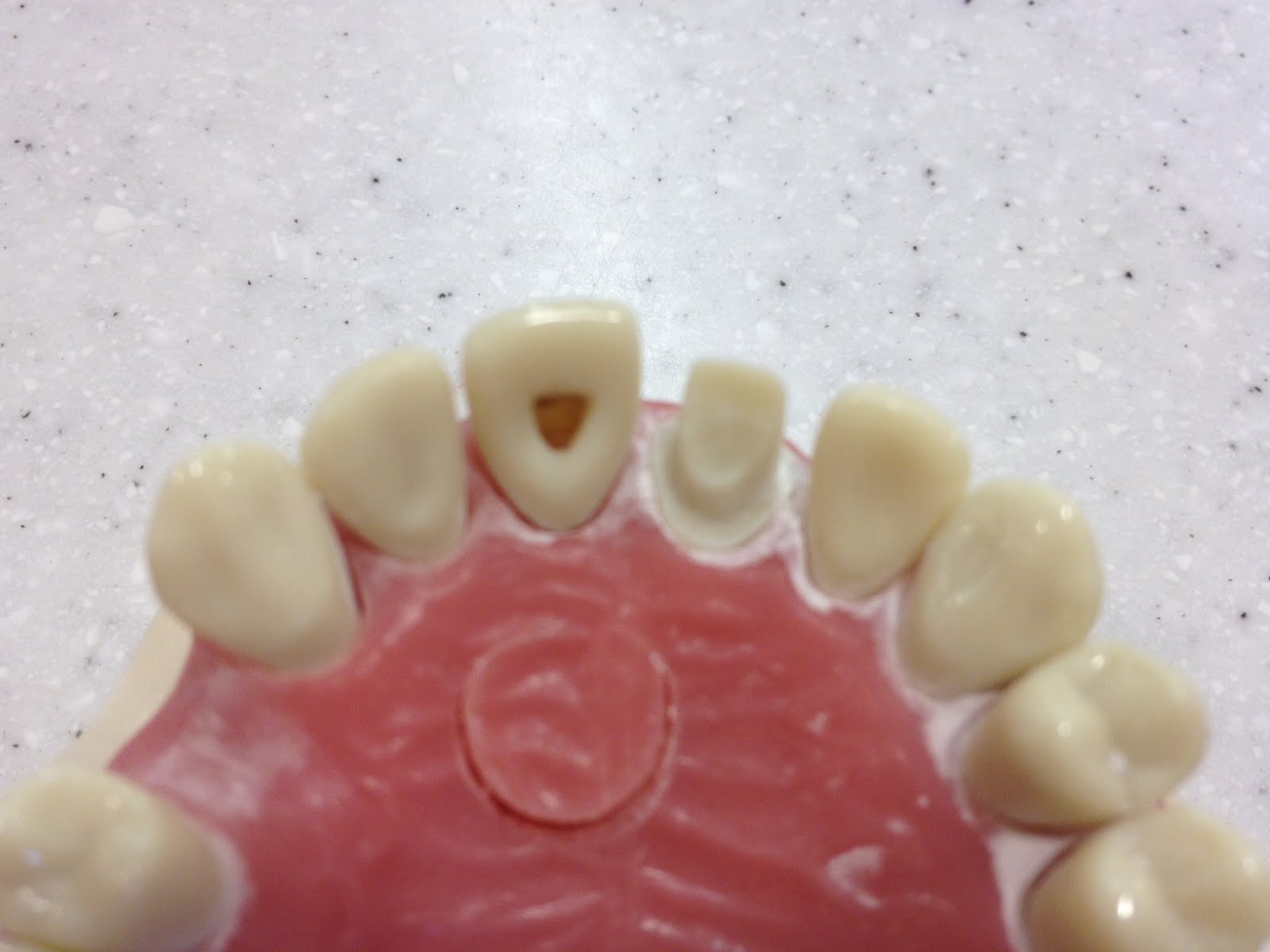 Paul Hung DDS Dental Advice How to Pass the NERB Manikin Endo and Pros