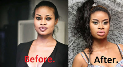 Nigeria Lady Paid $85,000 For Lip Surgery