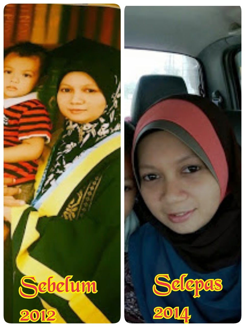 SEBELUM & SELEPAS SHAKLEE