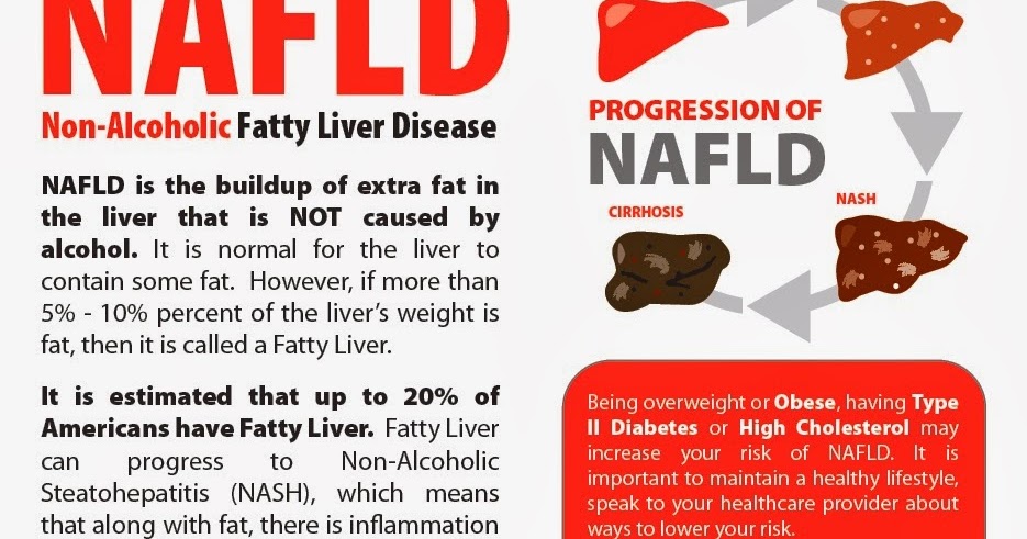 non alcoholic fatty liver disease Do you like this page tweet click for our online community. non alcoholic fatty liver disease Do you like this page tweet click for our online community.