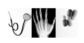 minimally invasive knee replacement surgery