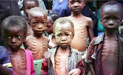 Foto orang kekurangan gizi 17 Foto orang kekurangan gizi 84