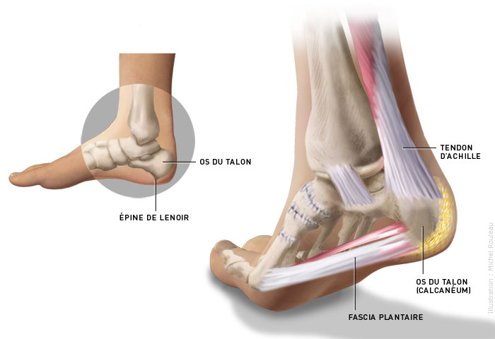 Mal Au Pied Talon Mal Aux Pieds Talons Hauts