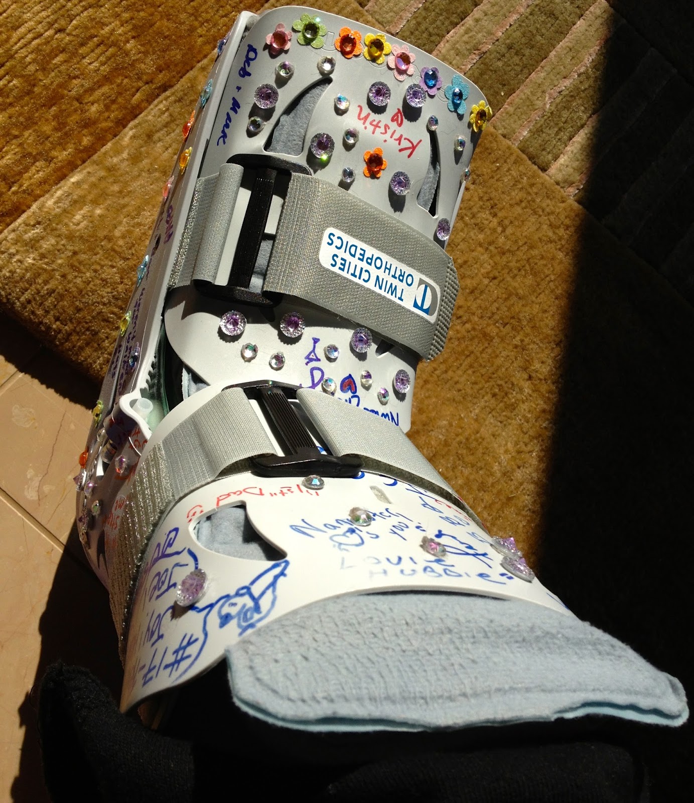 After LisFranc Surgery Married to the boot!