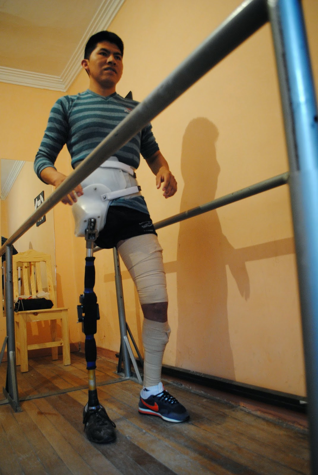 Life and Limb: Hip Disarticulation