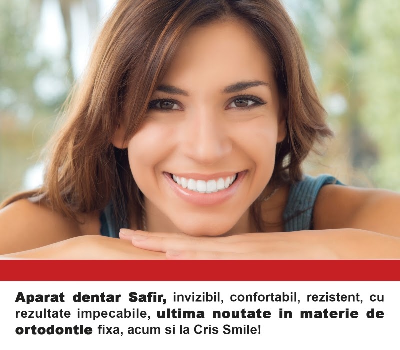 http://www.cris-smile.com/tratamente/aparat-dentar-fix-59