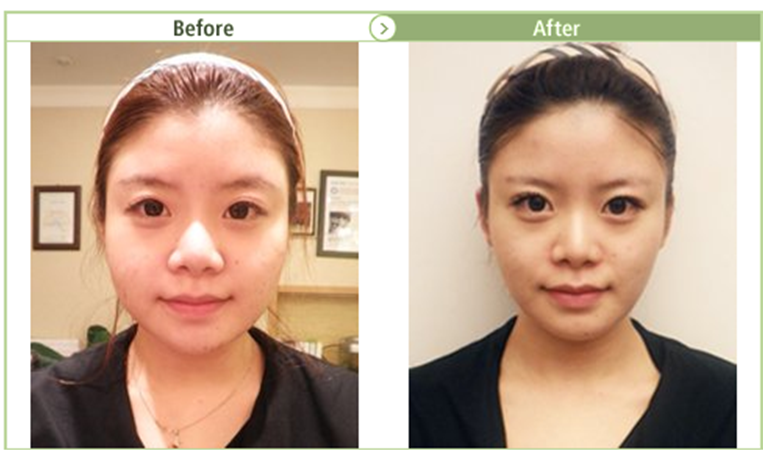 Yakson House How To Make Your Face Smaller Face Care Program