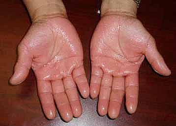 Sweaty Skin