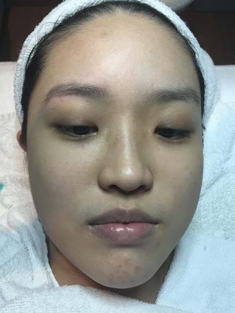 D'Skin D.C.M Revitalizing Skin Treatment Facial Review Lunarrive Singapore Lifestyle Blog